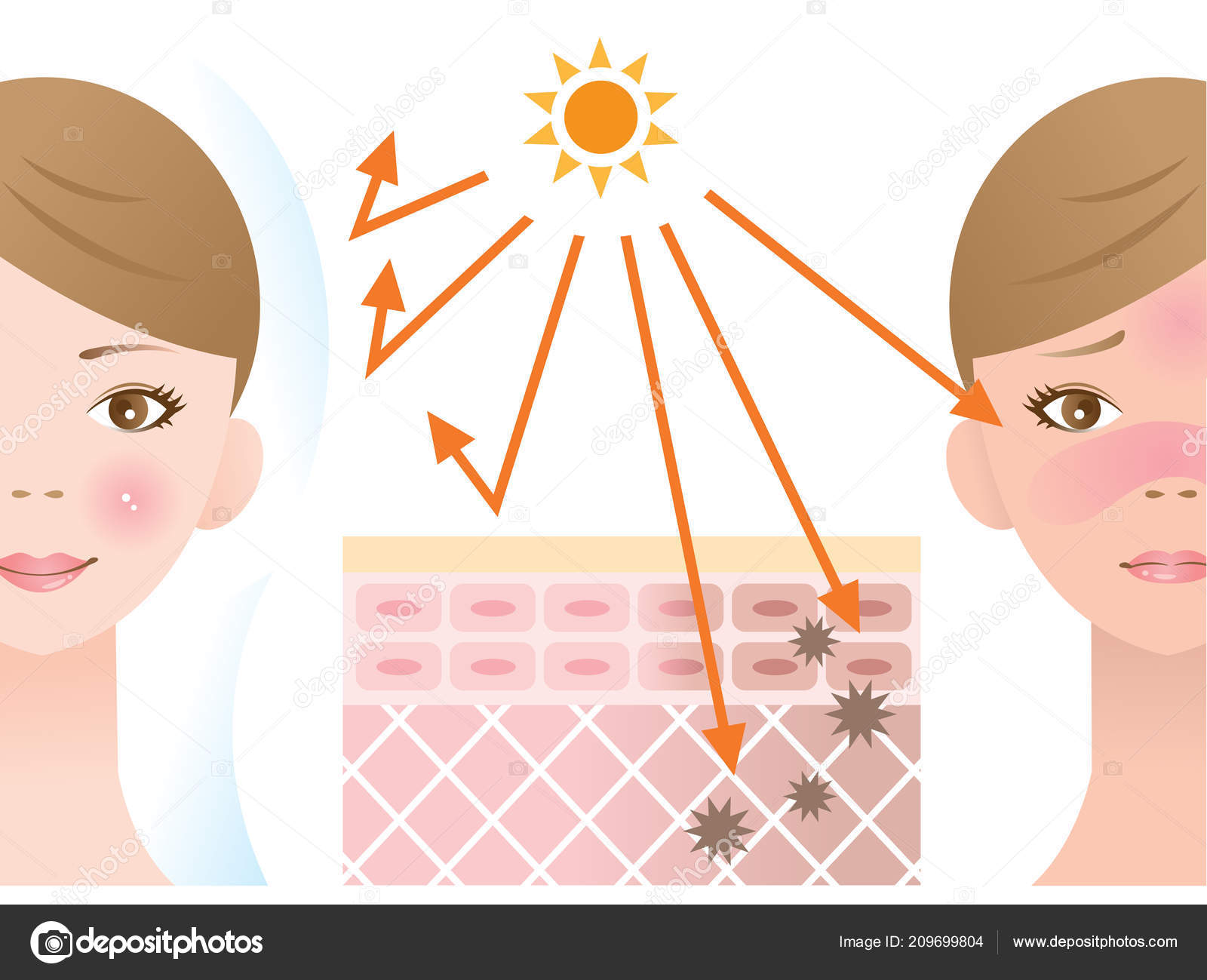 Kem chống nắng được xem là phương pháp hiệu quả ngăn tia UV